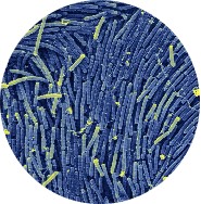 Bacillus-Koagulans.